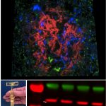 Exploring synapses in dementia