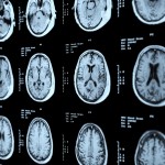 iStock_000019123445_Double