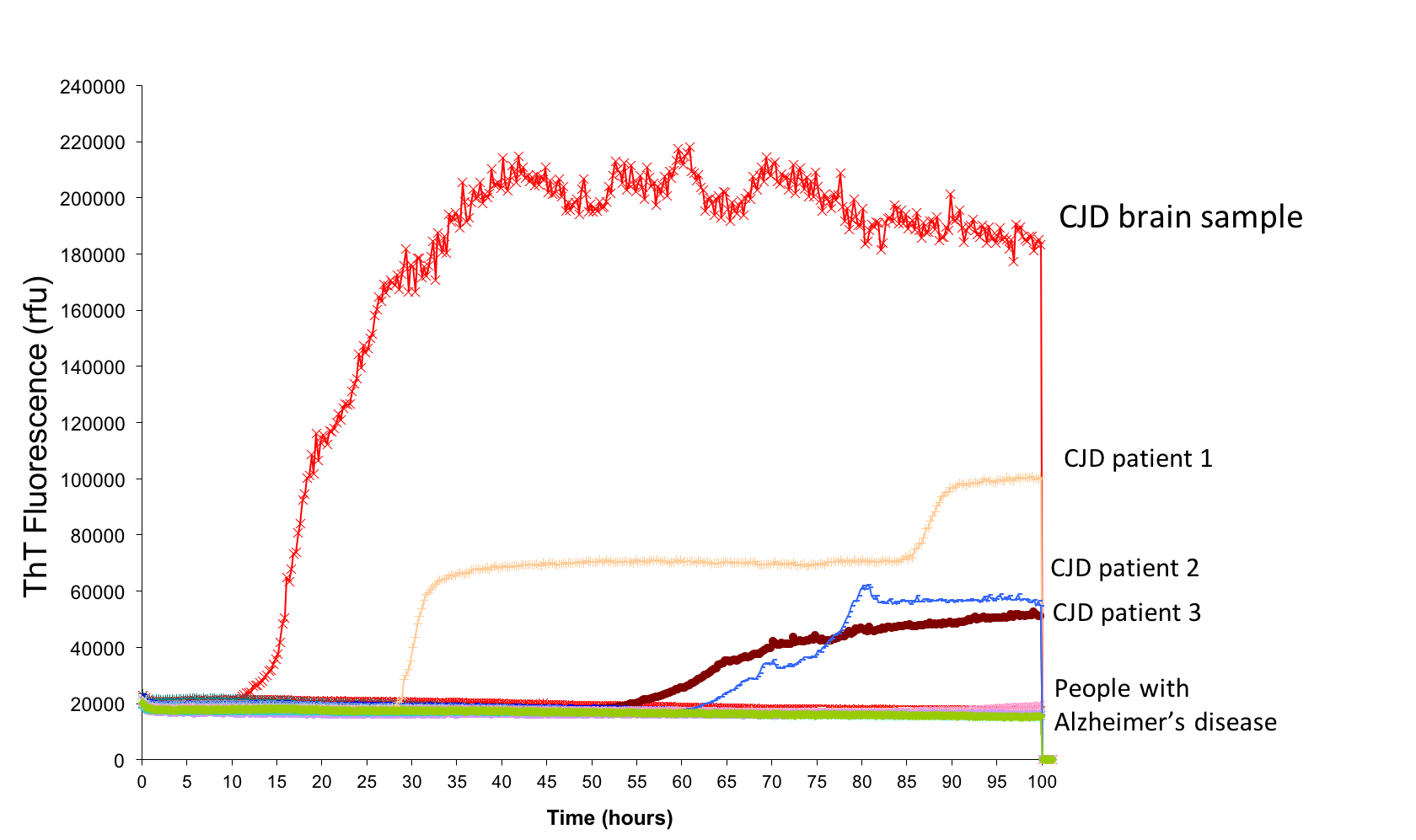 Specificity: tracking a biomarker over time in post-mortem tissue, CJD patients, and poeple with Alzheimer's disease